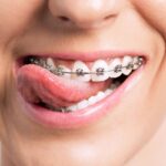 Orthodontist