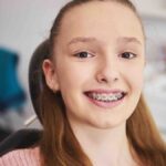 Braces